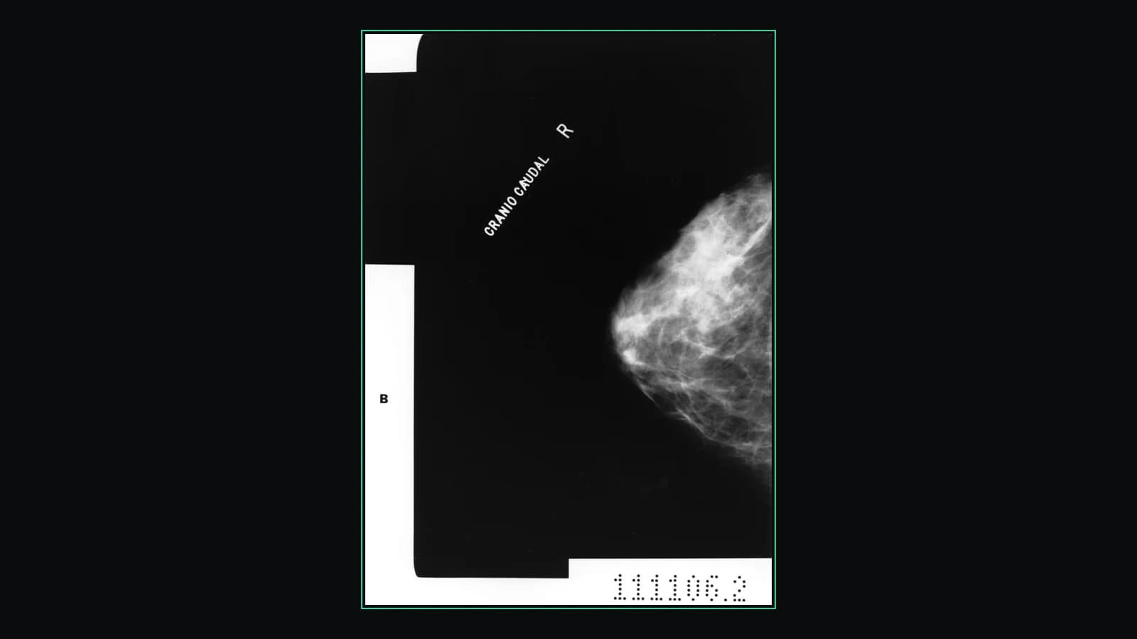 Free online mammogram viewer