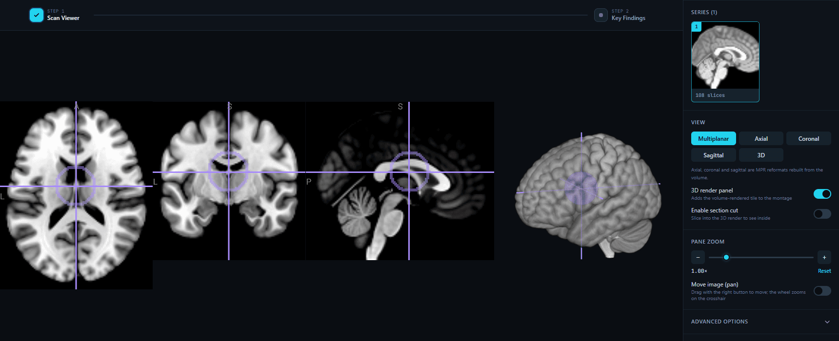 This is what your scan looks like here