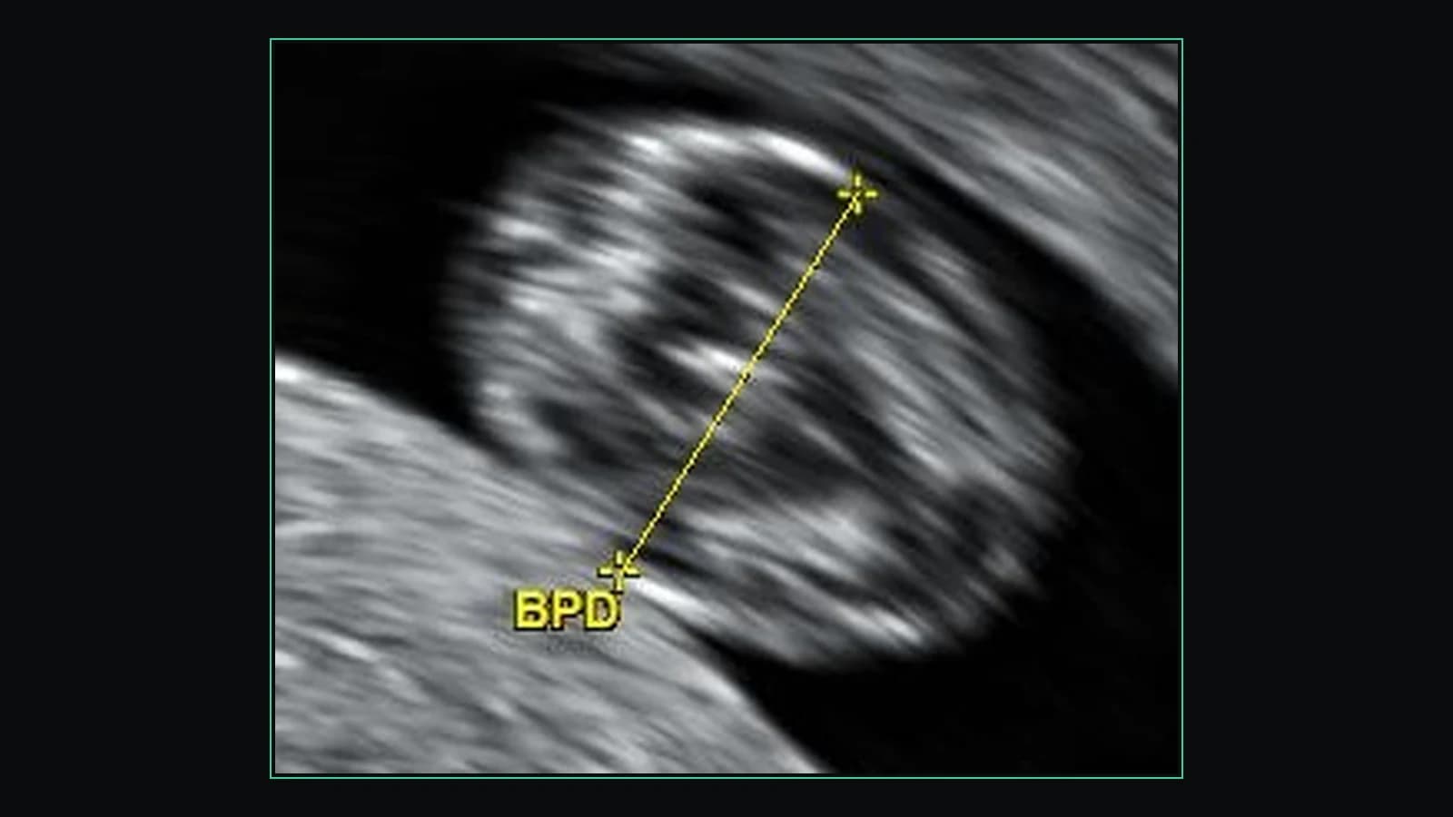 Free online ultrasound (DICOM) viewer