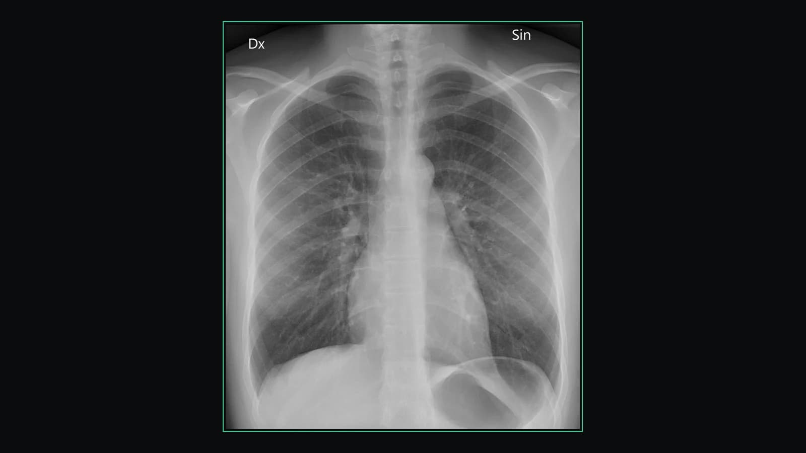 X-ray viewer online