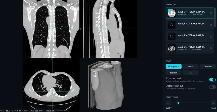 The viewer showing a chest CT in 2D and 3D