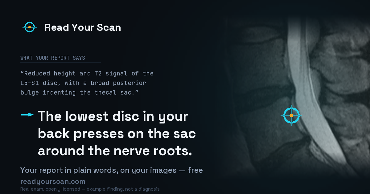 Read Your Scan